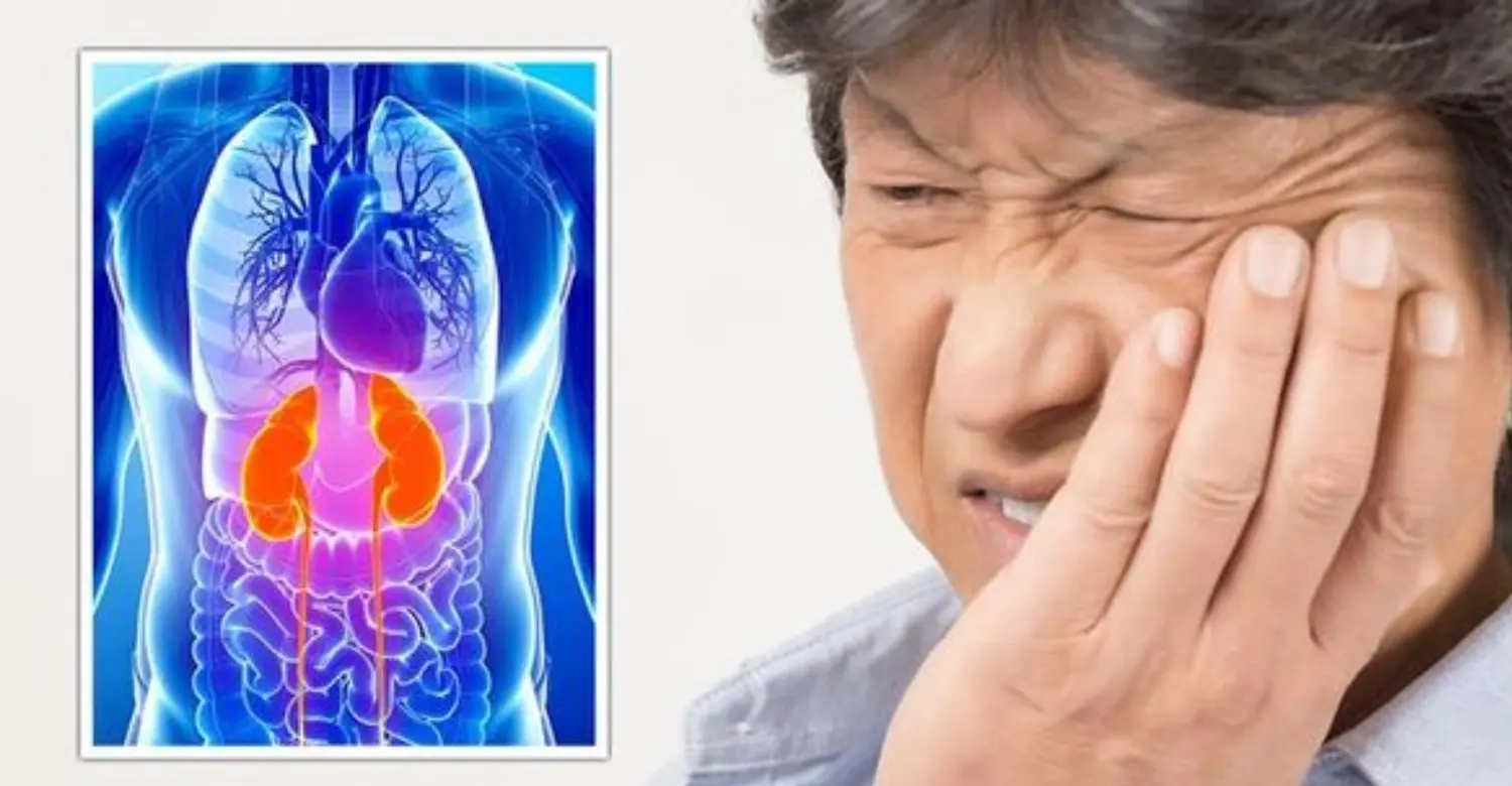 Kidney Disease and Oral Health 2